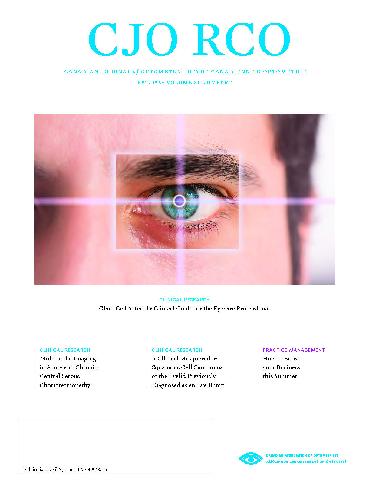 Cover of CJO Volume 79 Number 4 - Shows image of Topographical map corneal opacities present centrally in the left eye